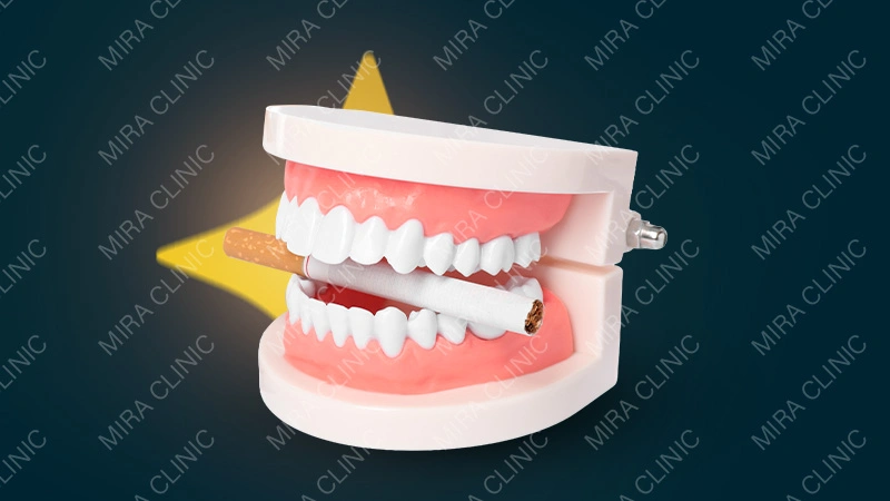 Maintenance Protocol for Smokers